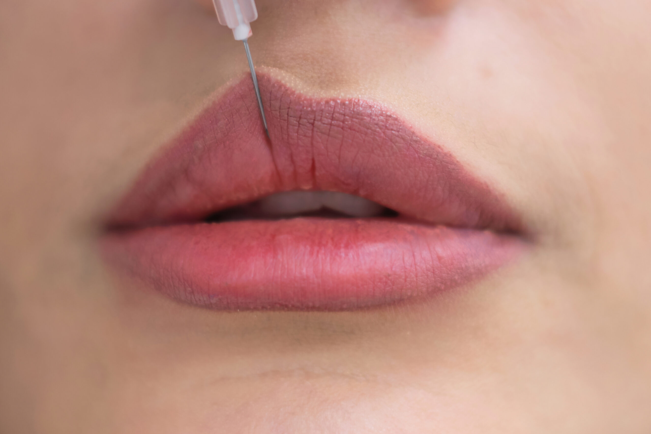 Obrazek przedstawia usługę Lip enhancement