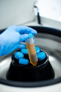 Obrazek przedstawia usługę Osocze Bogatopłytkowe i fibryna (PRP & PRF)