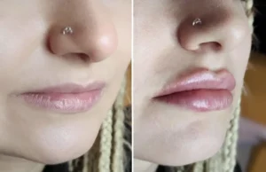 Obrazek przedstawia usługę Gallery