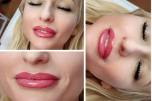 Obrazek przedstawia usługę Gallery